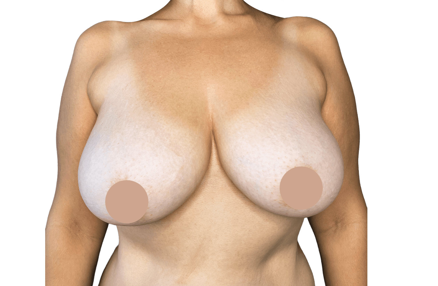Antes Caso 01